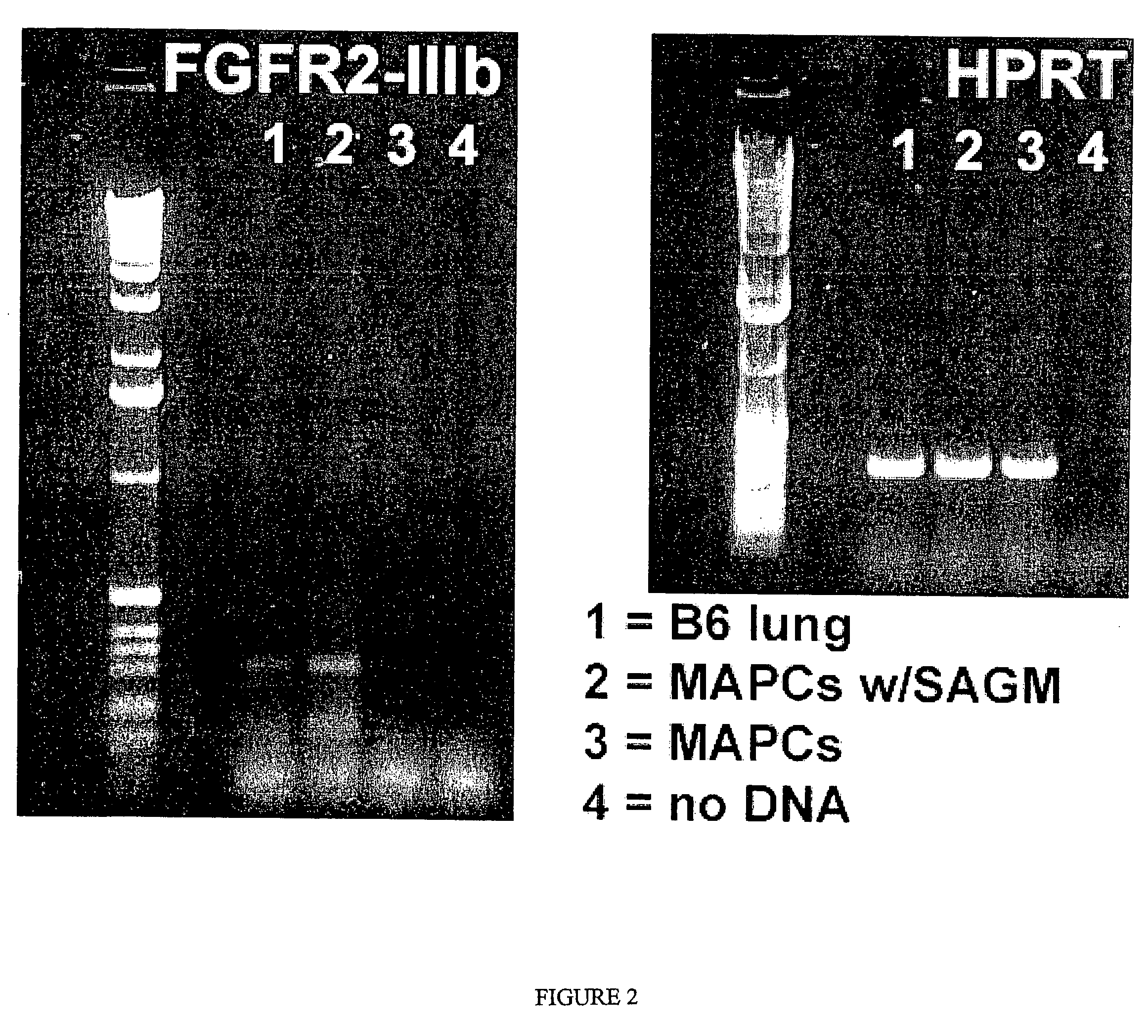 Mapc Generation of Lung Tissue