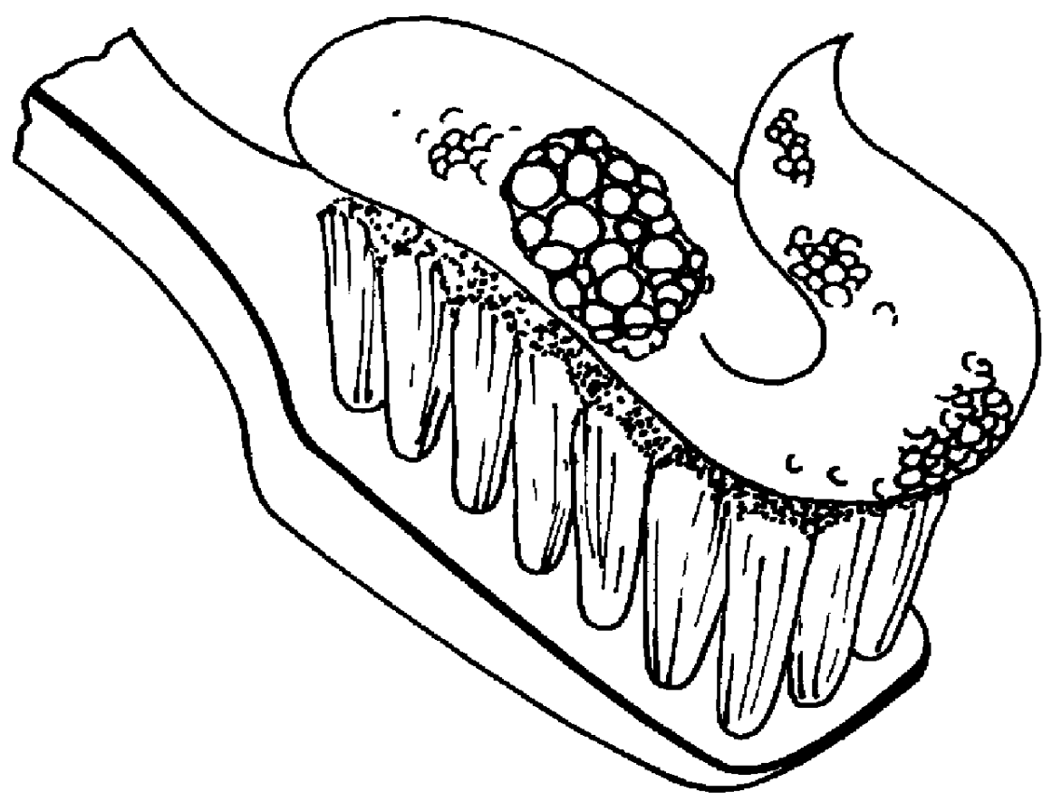 Delivery system for dental agents