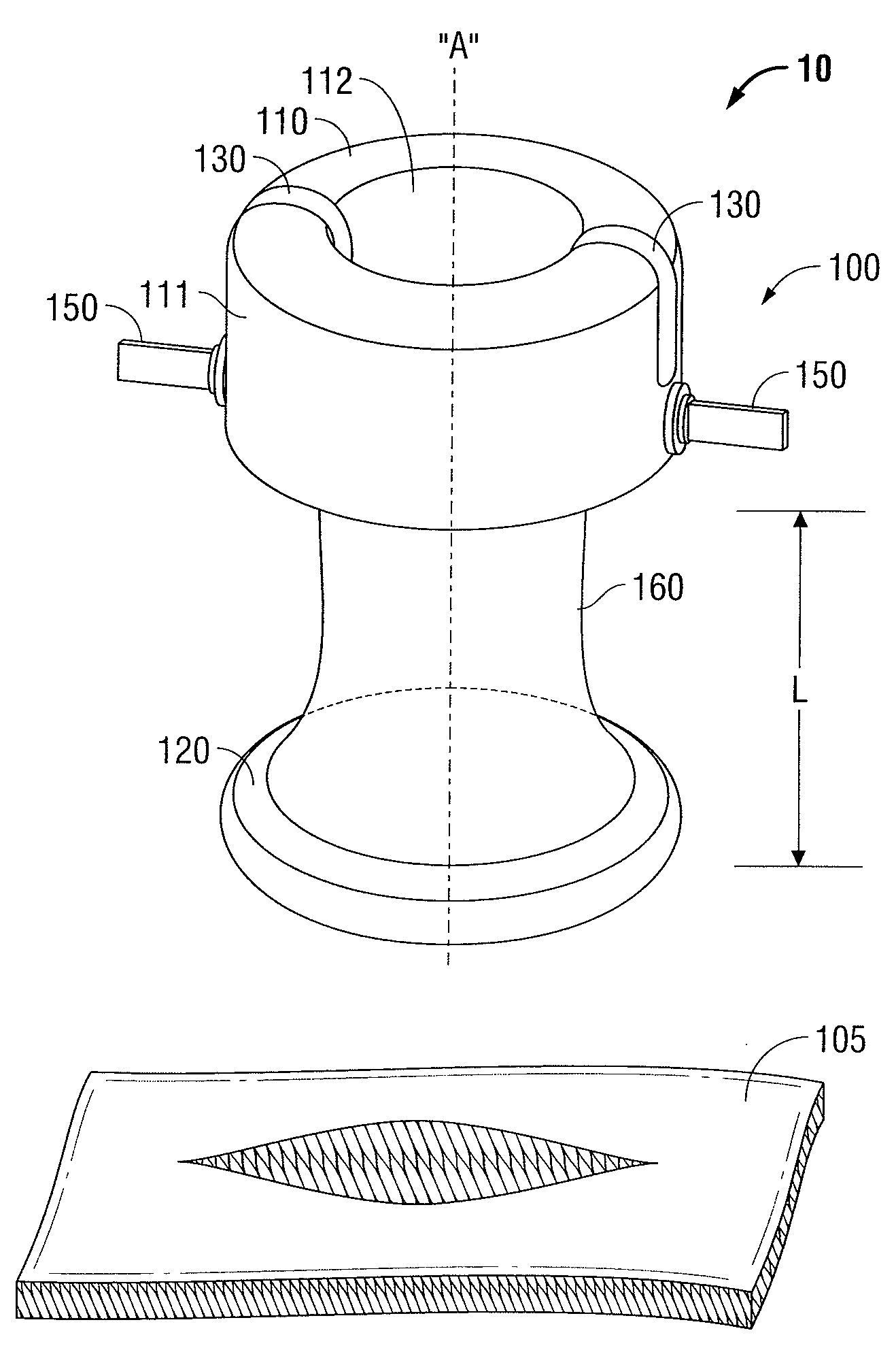 Bariatric foam port