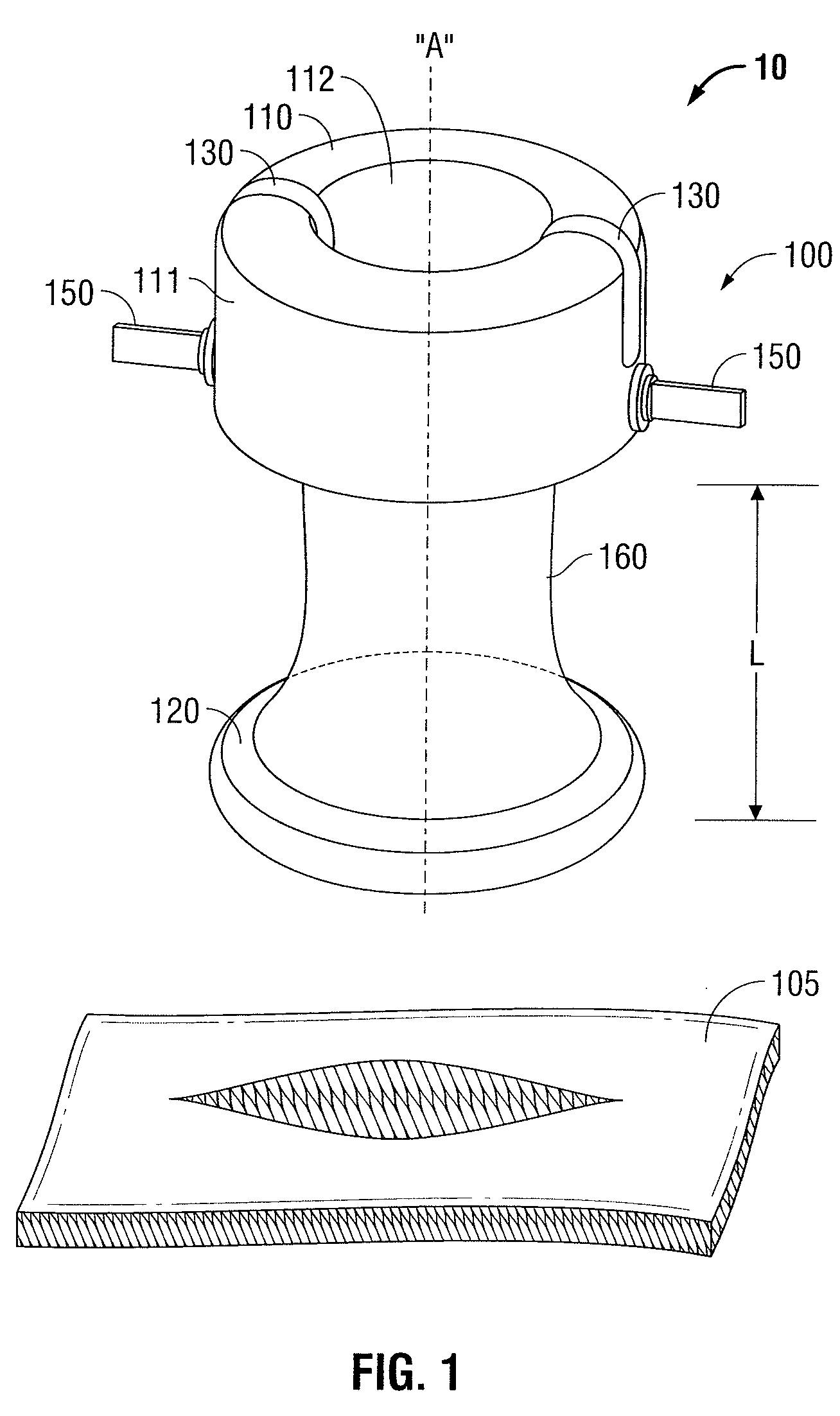 Bariatric foam port