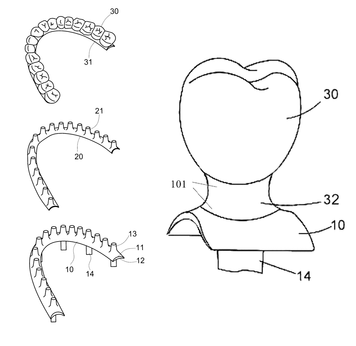 Artificial teethridge and fang