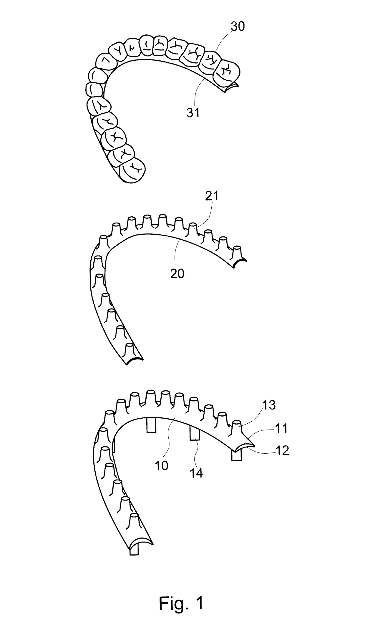 Artificial teethridge and fang