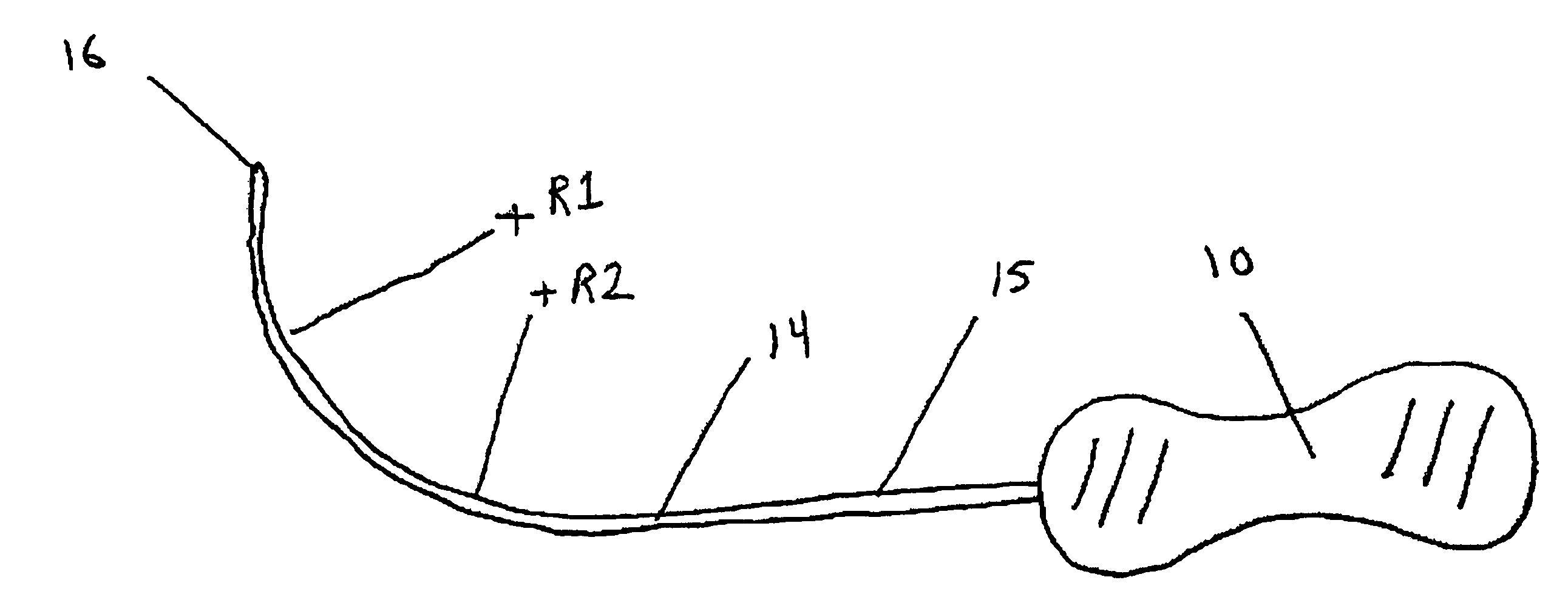 Method and apparatus for treating pelvic organ prolapse