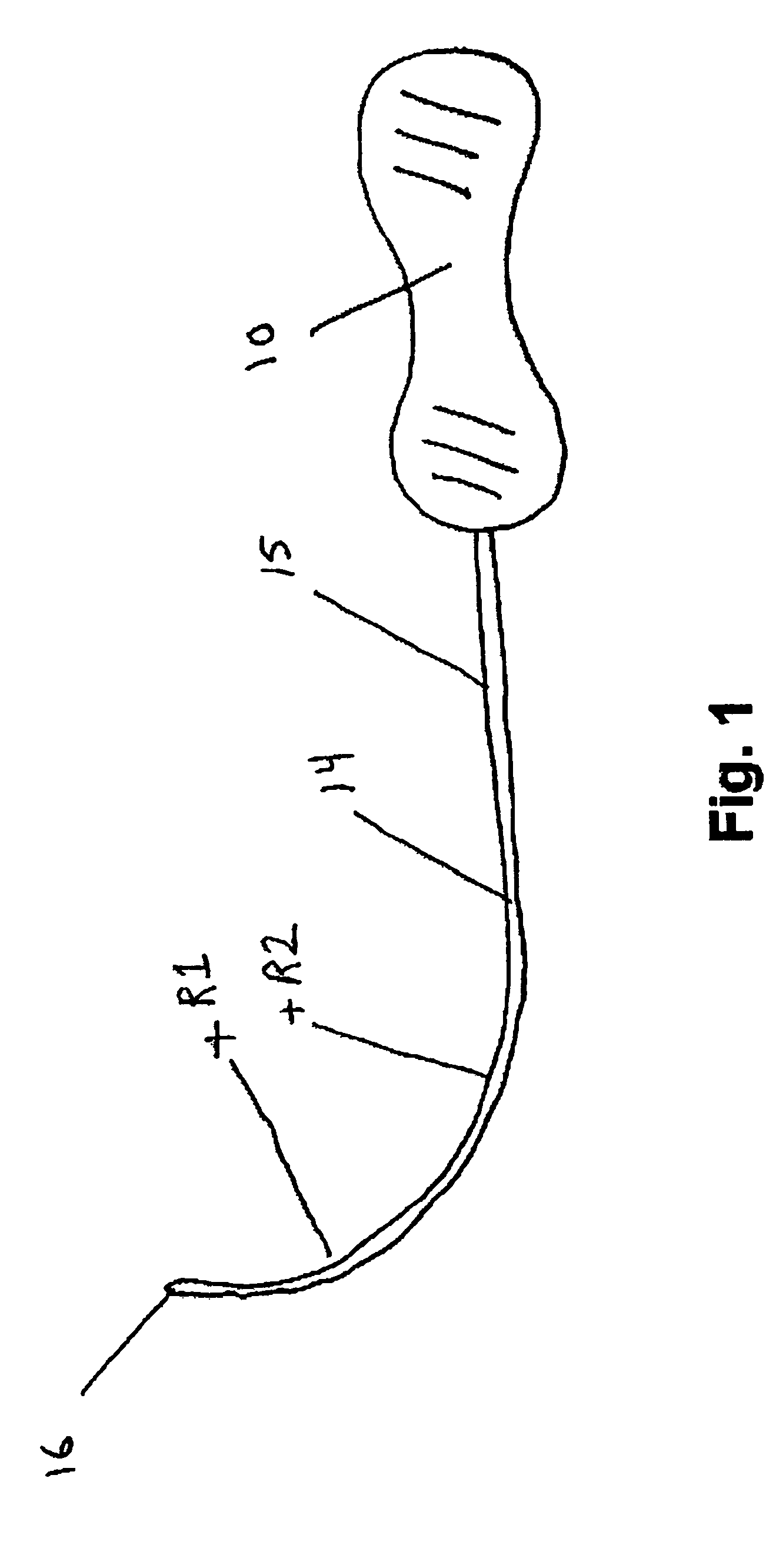 Method and apparatus for treating pelvic organ prolapse