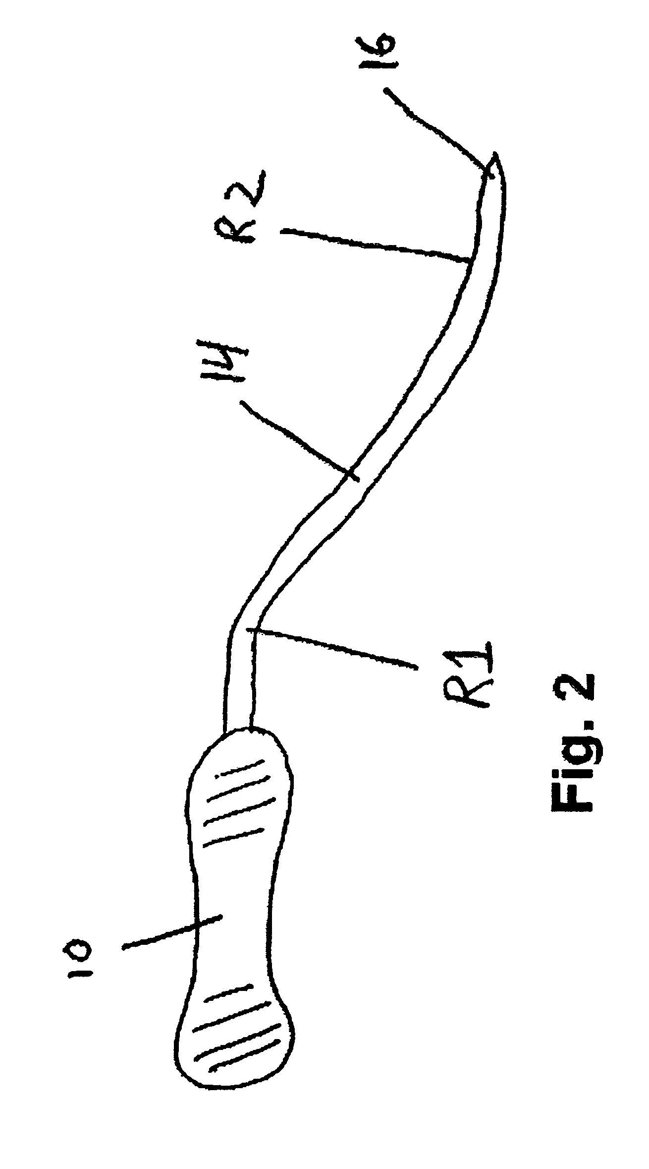 Method and apparatus for treating pelvic organ prolapse