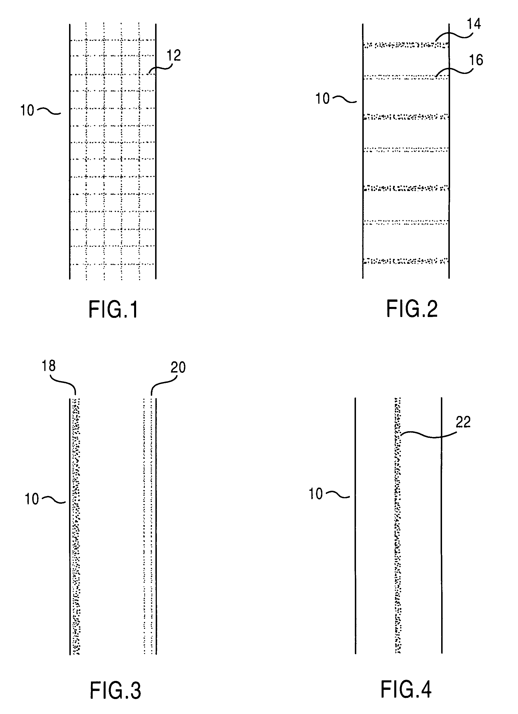 Patterning on surface with high thermal conductivity materials