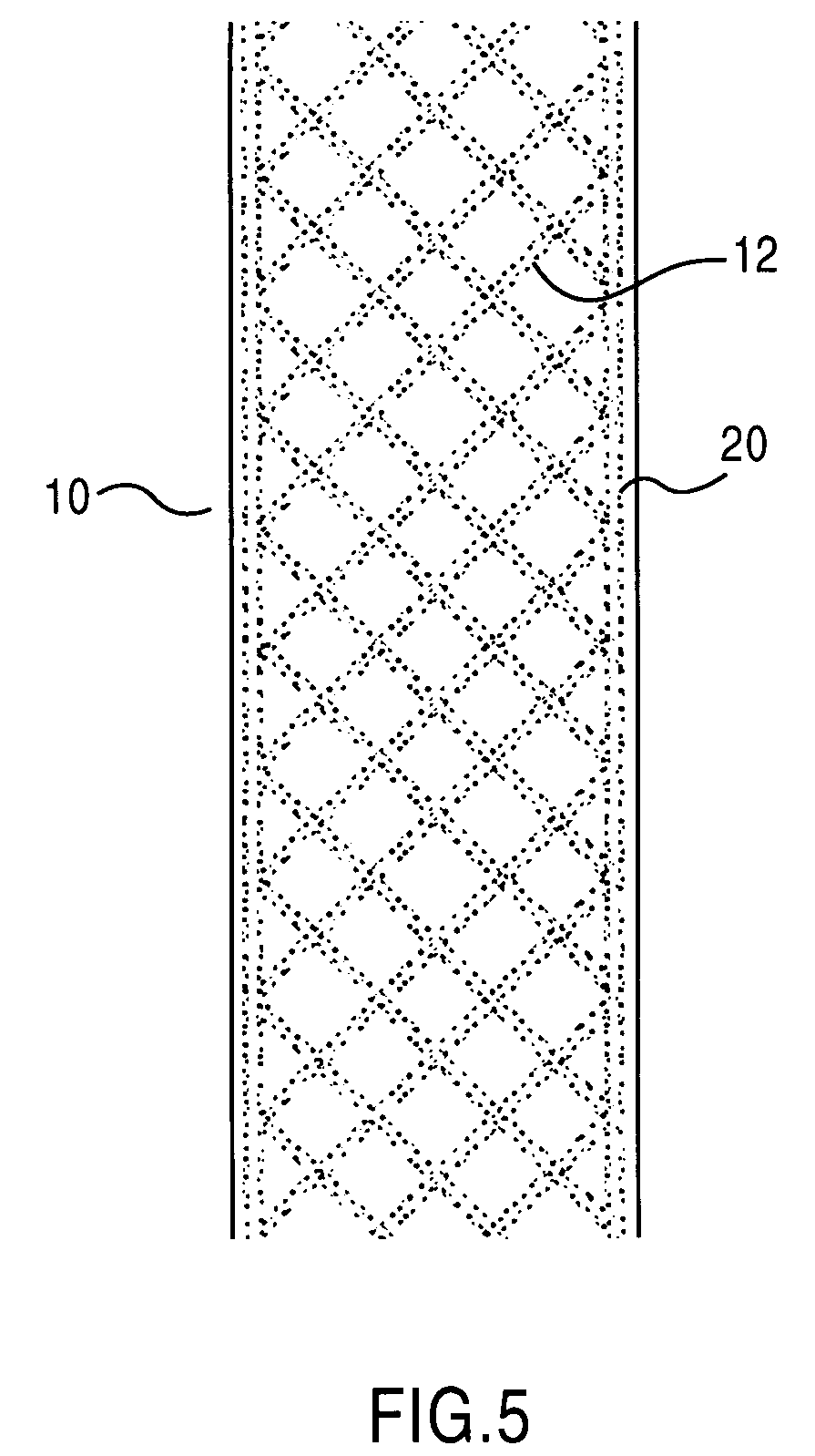 Patterning on surface with high thermal conductivity materials