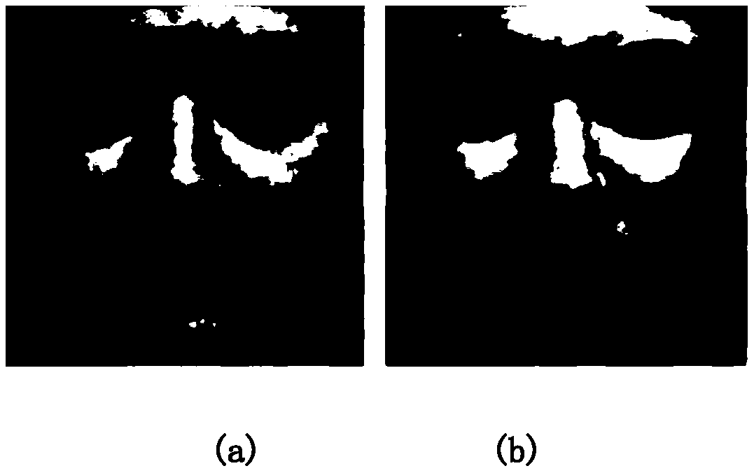 Living body detection method based on facial microexpression recognition