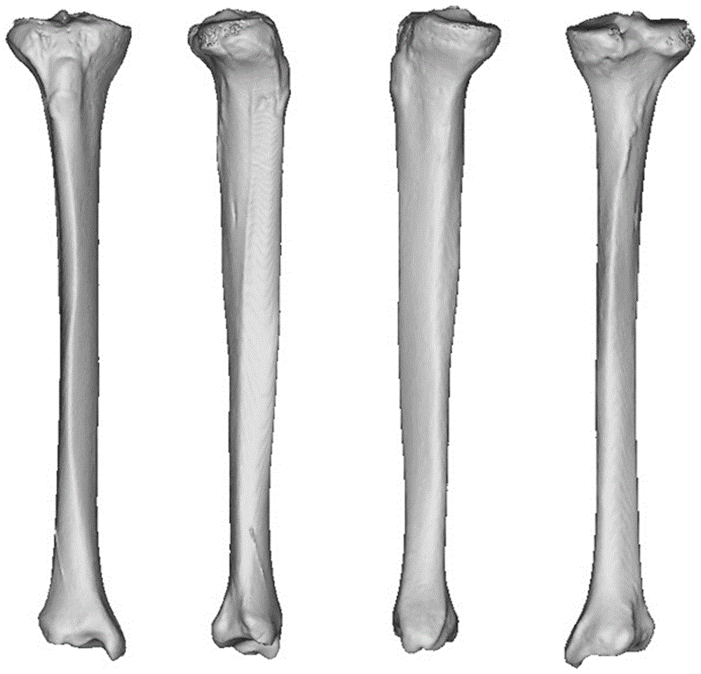 CT gray-material property assignment finite element modeling method used for osteotomy