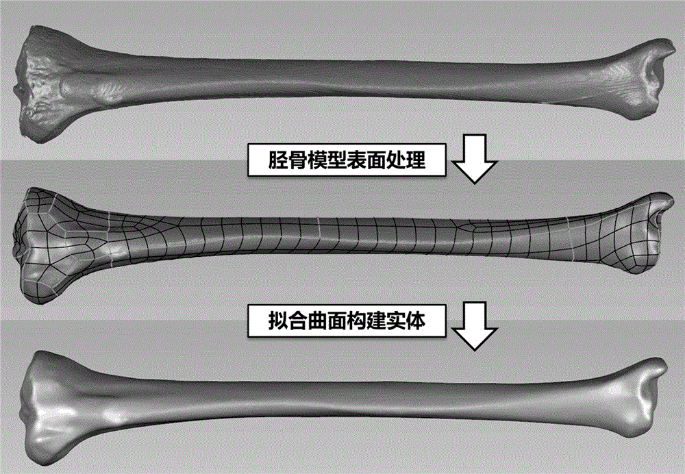 CT gray-material property assignment finite element modeling method used for osteotomy