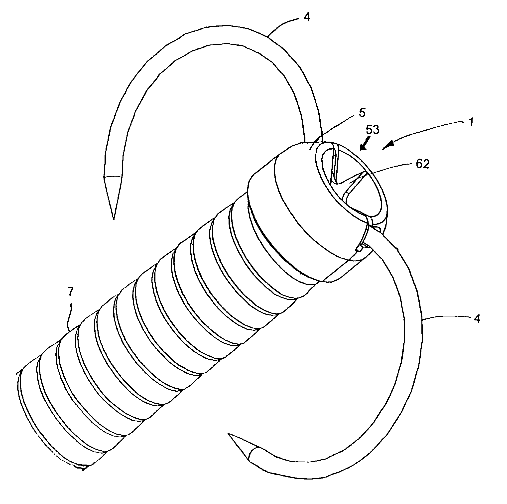 Tissue retractor and method for using the retractor