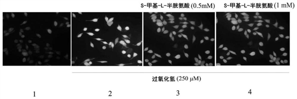 Medicine and functional food for preventing and treating post-traumatic stress syndrome