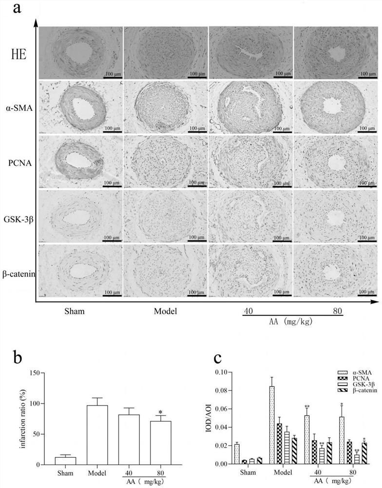 Total saponins of Yingbupu and its application in the preparation of drugs for treating restenosis after vascular injury