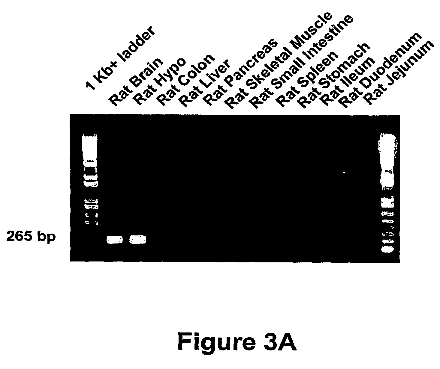 Methods of using GPR101 receptors to identify modulators of hypothalamic proopiomelanocortin (POMC)-derived biologically active peptide secretion