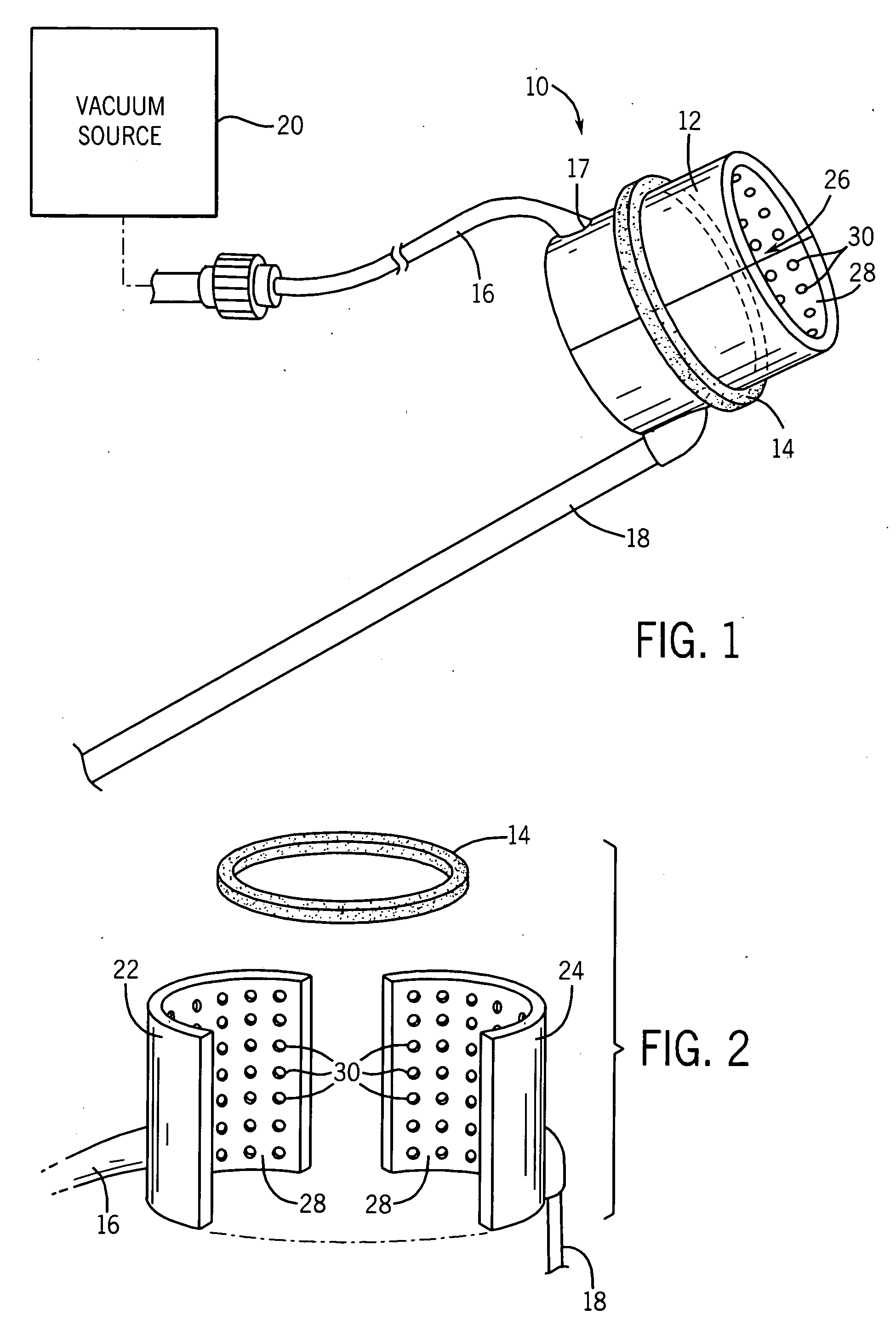 Blood vessel holding and positioning system