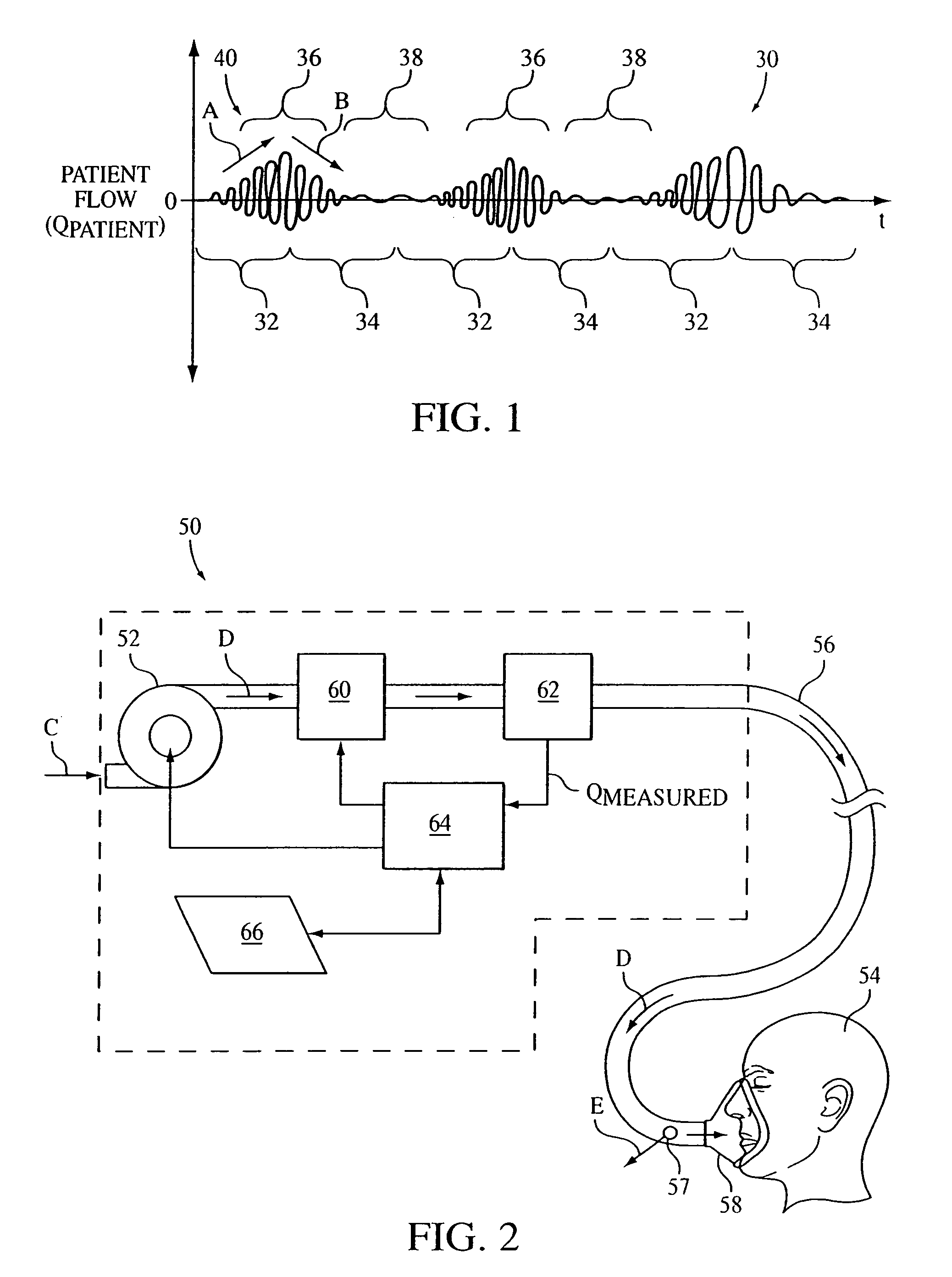 Method and apparatus for treating Cheyne-Stokes respiration