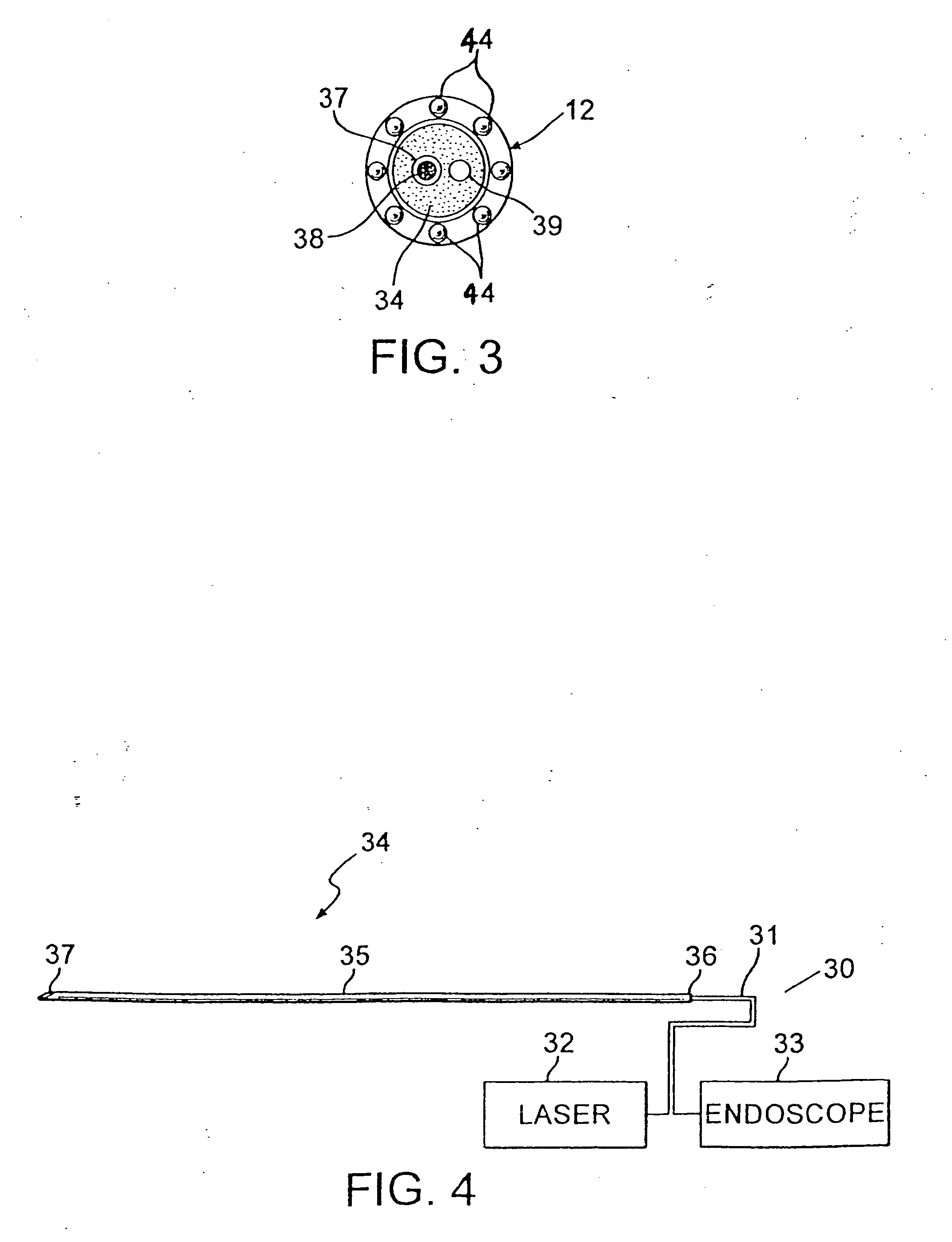 Visualizing ablation system