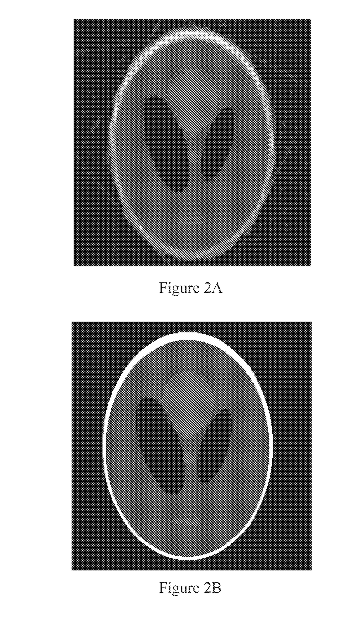 Automatic system calibration method of x-ray ct