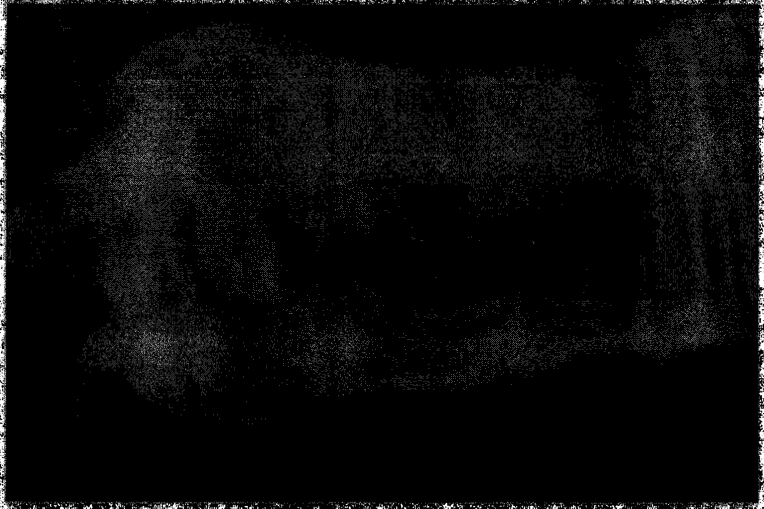 Method for building chronic wound animal experiment model