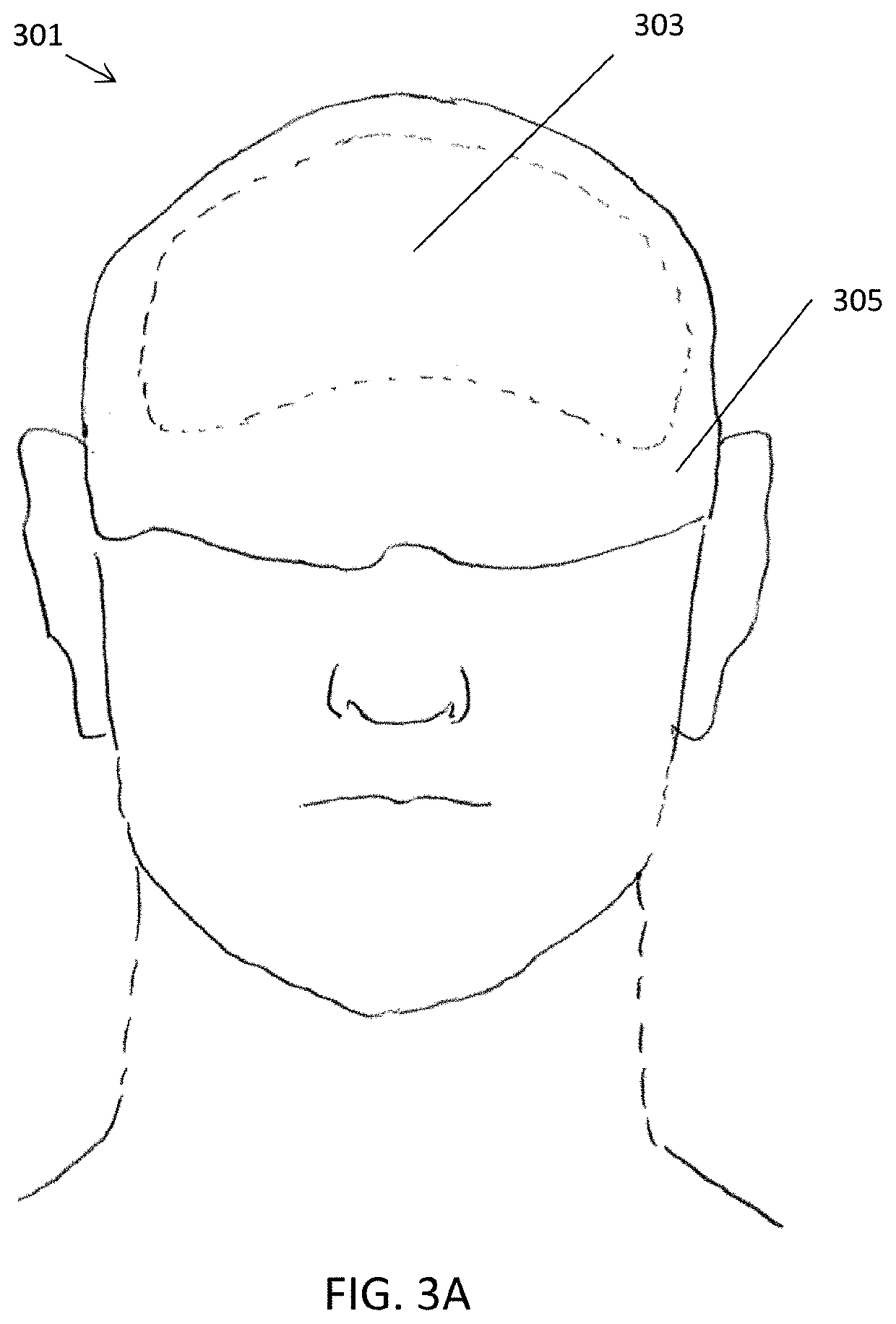 Non-invasive brain temperature regulating devices for enhancing sleep