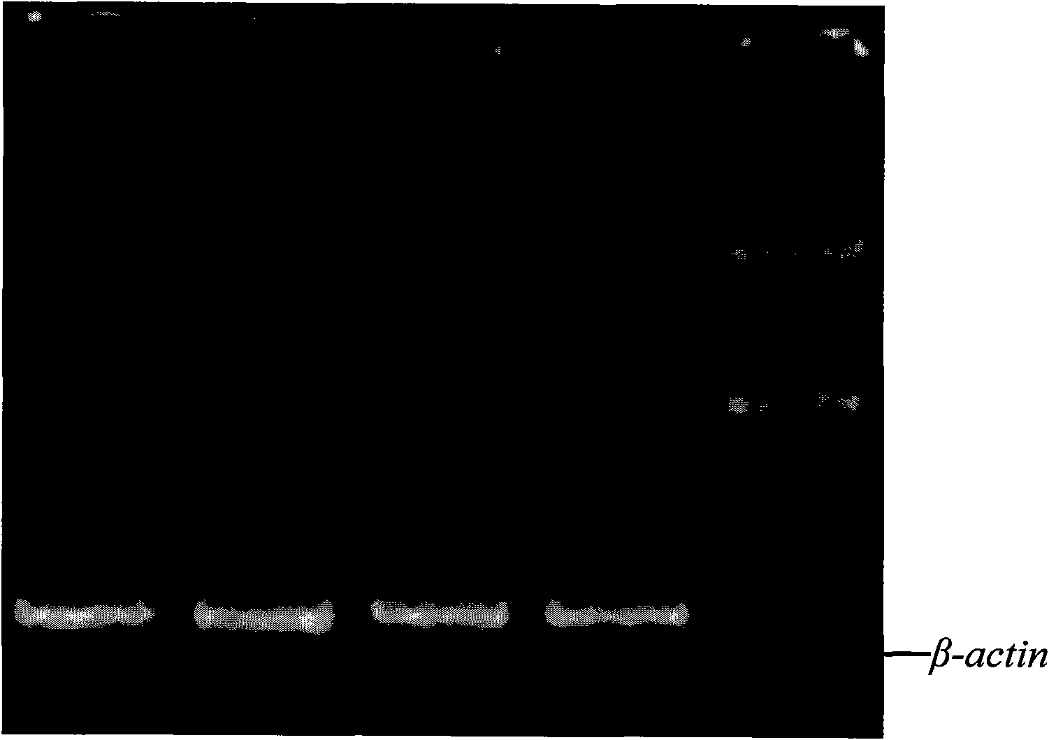 Extraction method of apostichopus japonicus body-wall total RNA