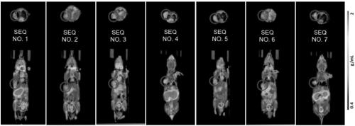 Application of radiolabeled anti-nano antibody in prognosis and diagnosis of cancer