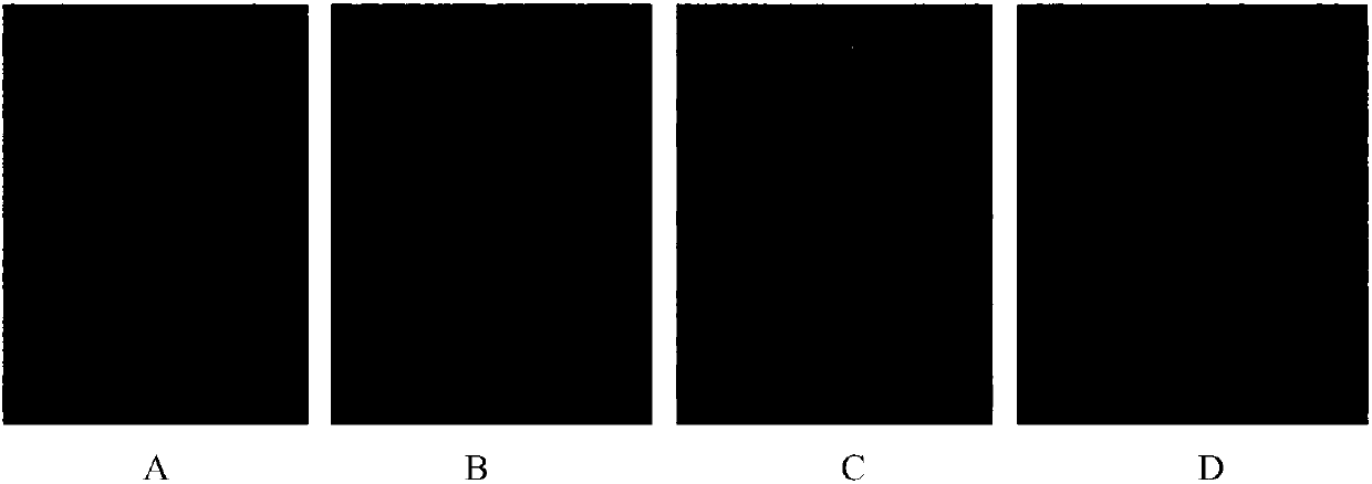 Application of sinomenine in the preparation of drugs for preventing and treating myocardial hypertrophy