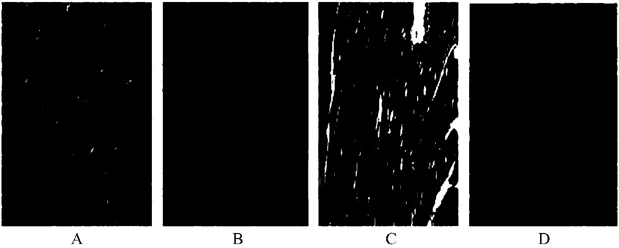 Application of sinomenine in the preparation of drugs for preventing and treating myocardial hypertrophy