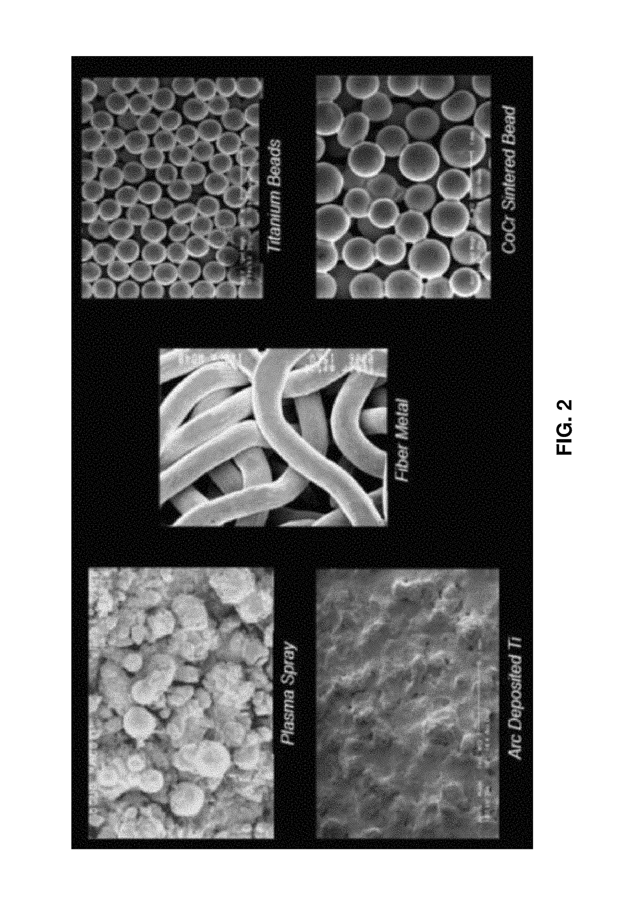 Porous coating for orthopedic implant utilizing porous, shape memory materials