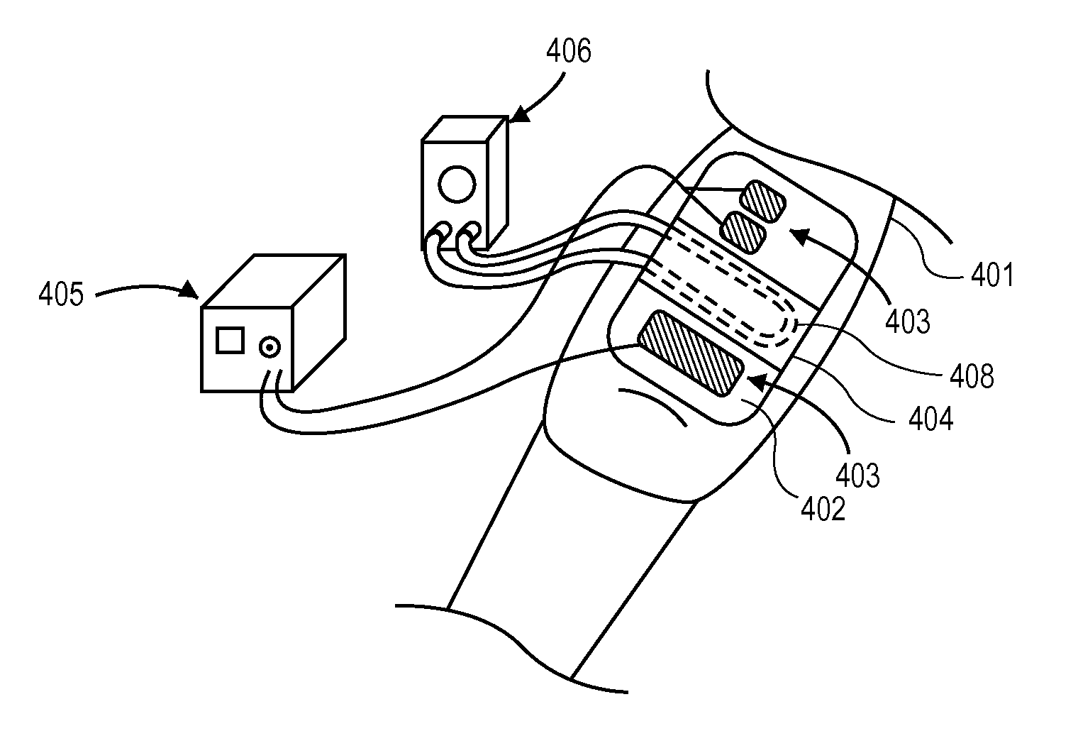 Systems and Methods of Powered Muscle Stimulation Using an Energy Guidance Field