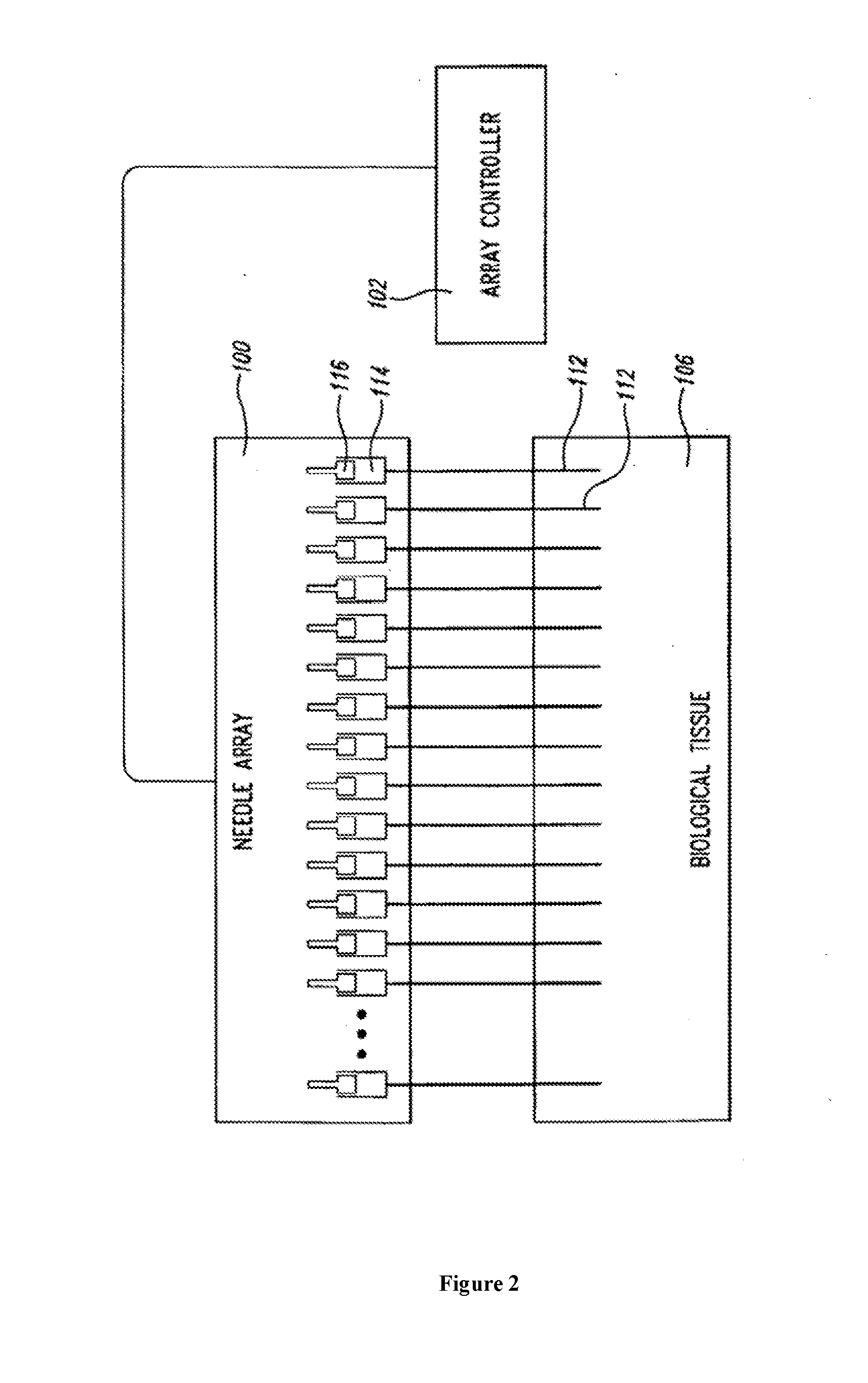 Modulation neural pathways