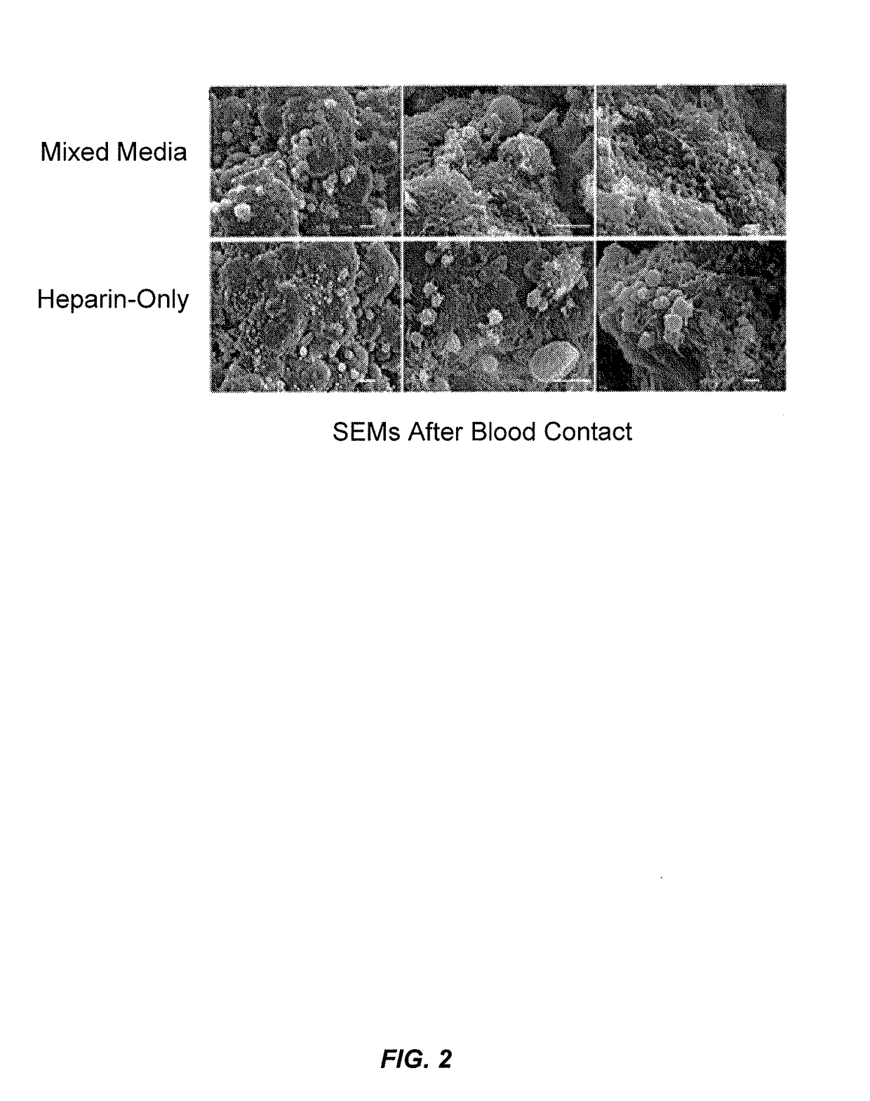 Blood filtration system containing mannose coated substrate