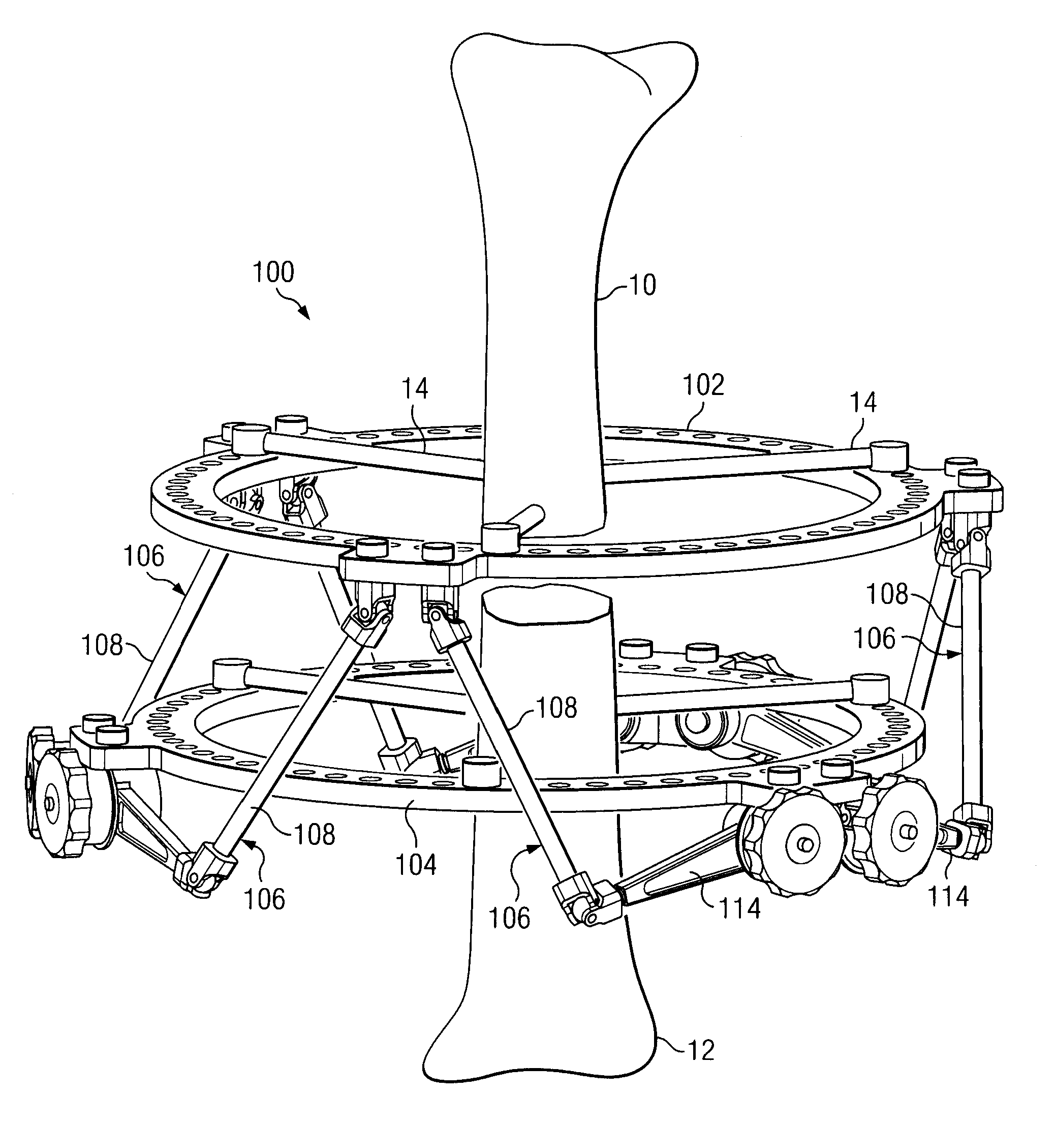 Hexapod External Fixation System with Collapsing Connectors