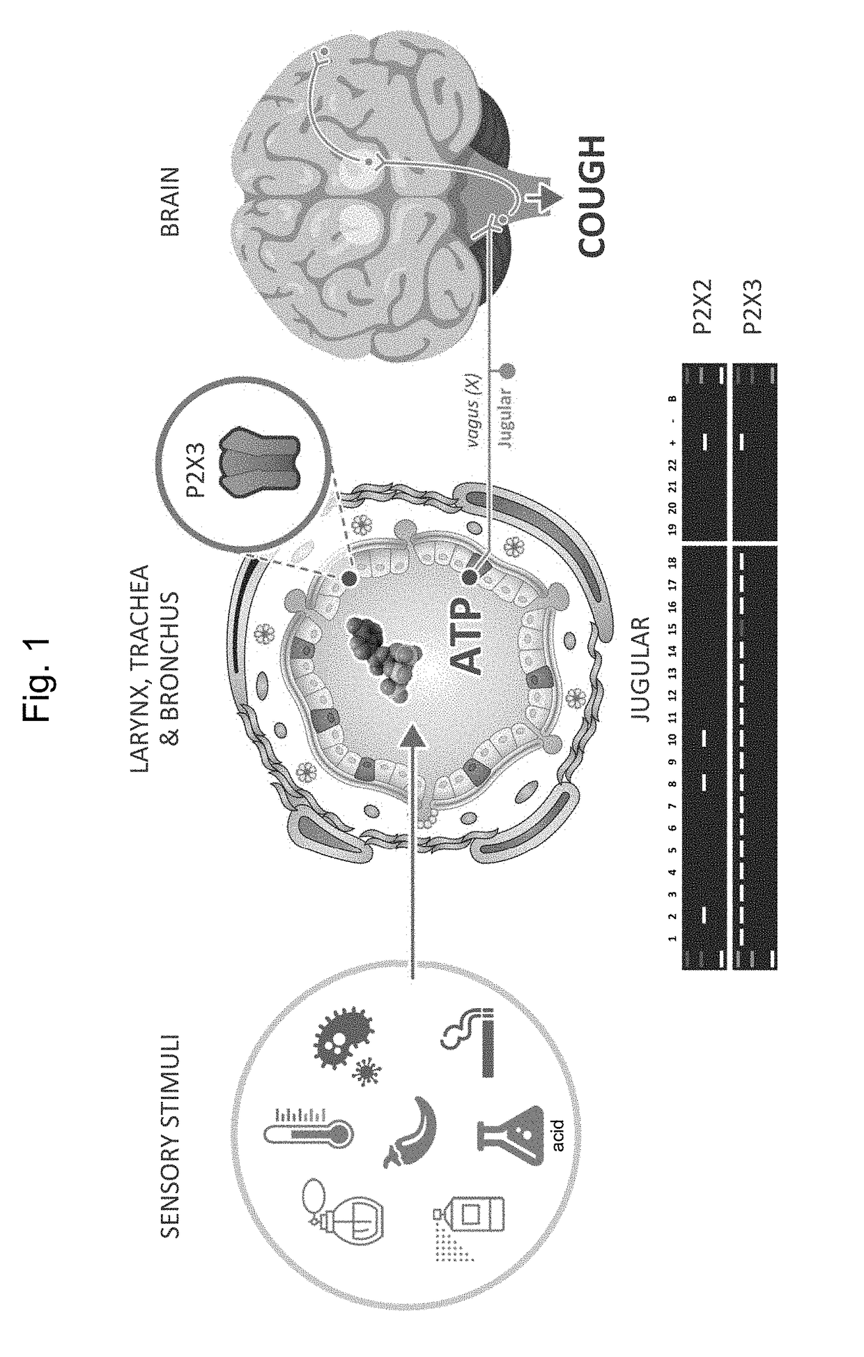 Selective P2X3 modulators