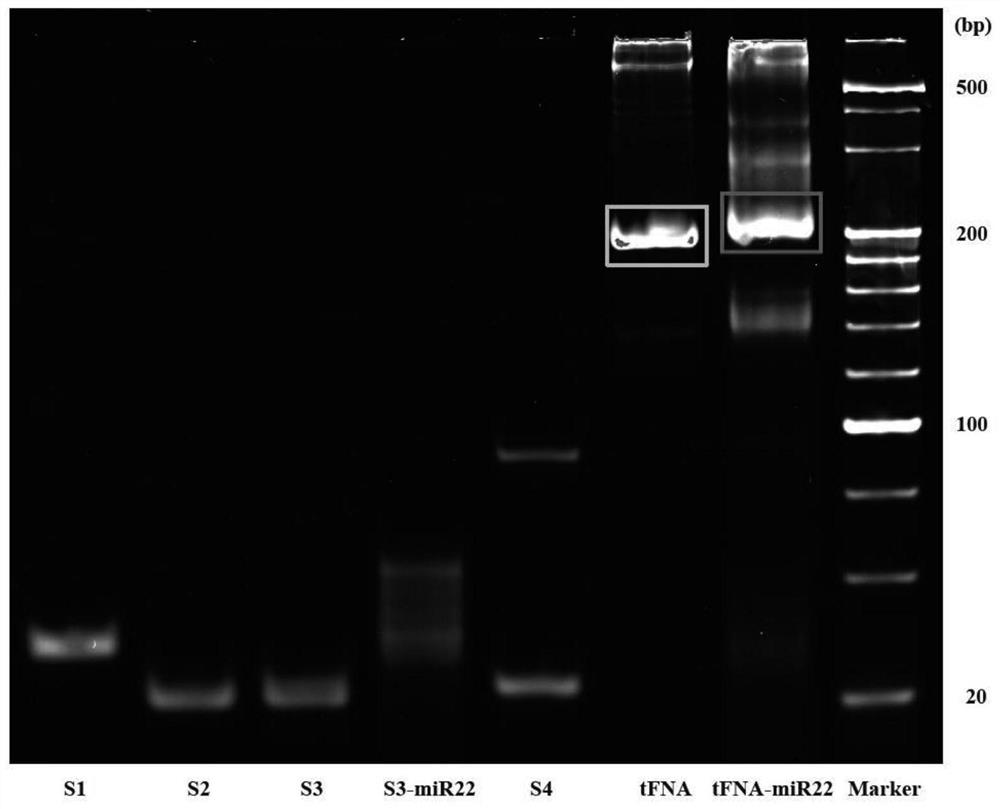 A compound for treating optic nerve disease and its preparation method and use