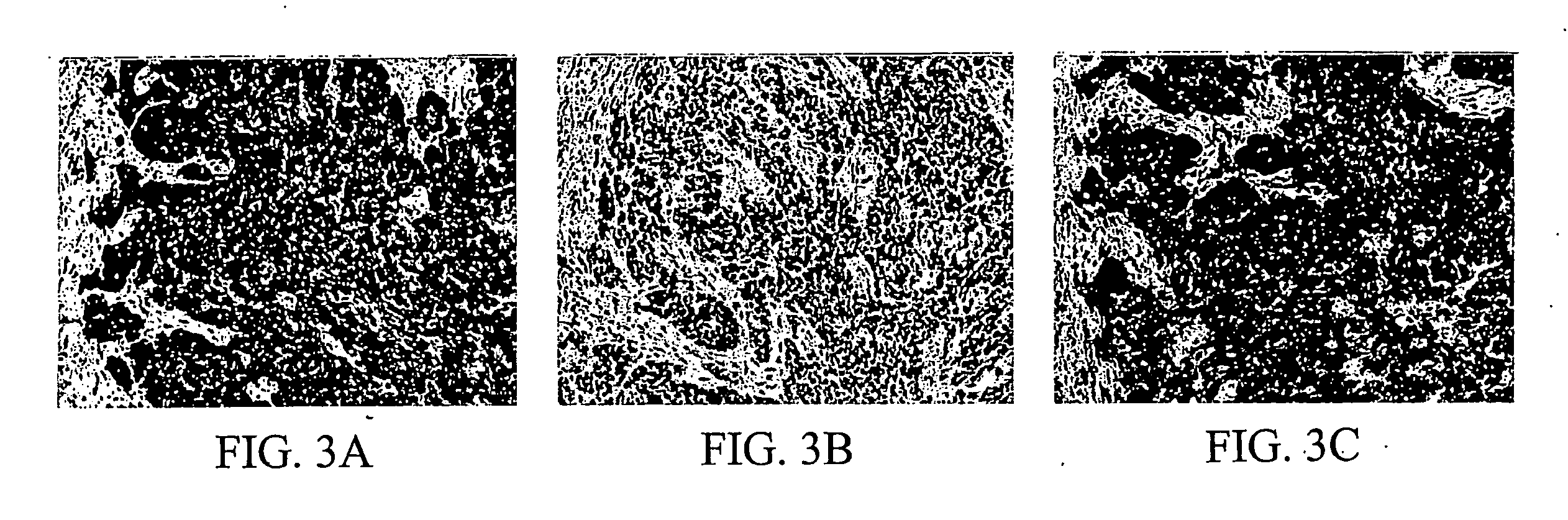 Neoplasm specific antibodies and uses thereof