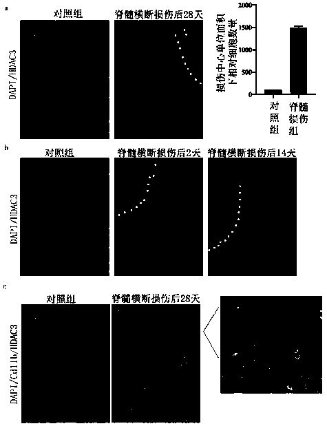 Drug for promoting recovery from chronic spinal cord injury and preparation method and application thereof