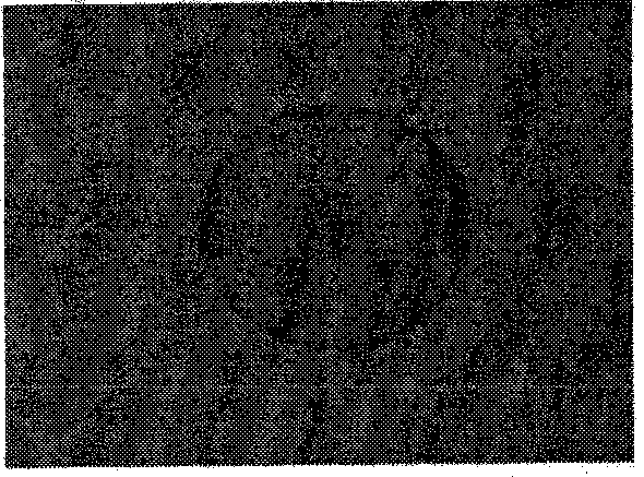 Vincristine lipid microbubble and preparation method thereof