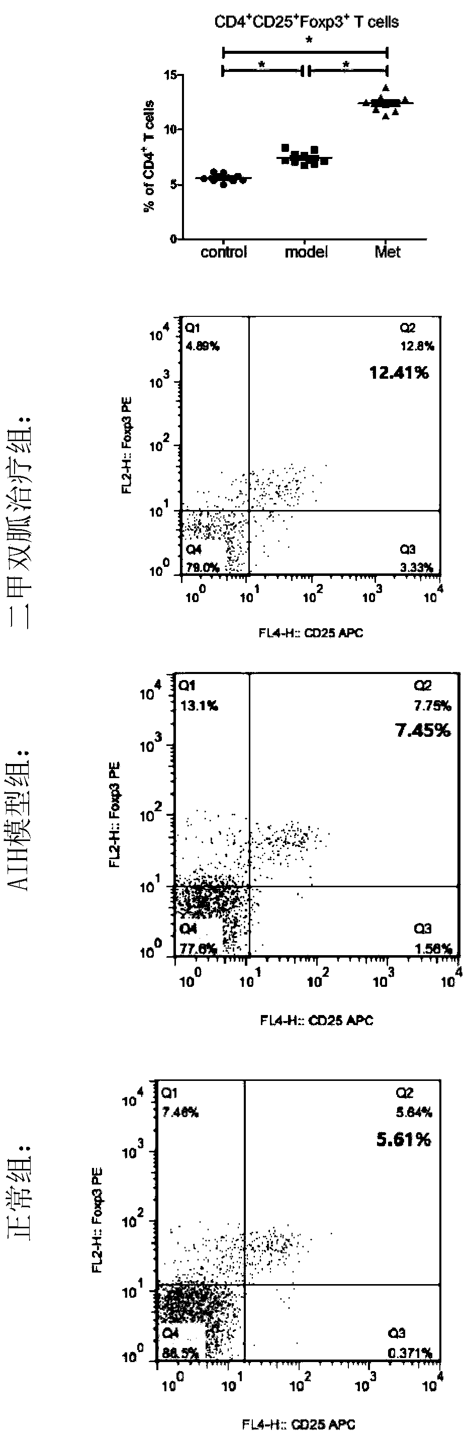 Application of metformin in treatment of autoimmune hepatitis of mouse