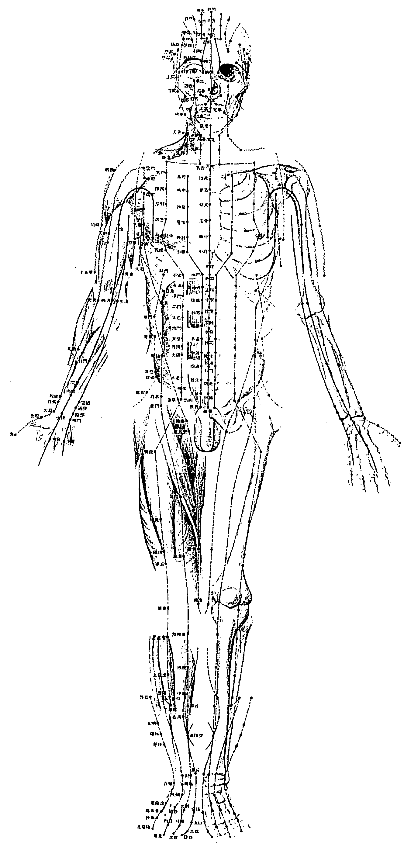 Method for treating disease using motion style treatment