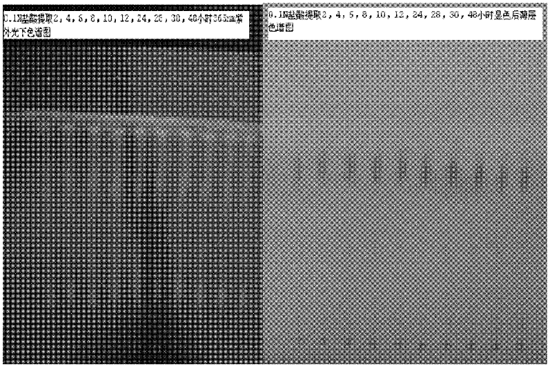 Method for preparing sinomenine hydrochloride injection