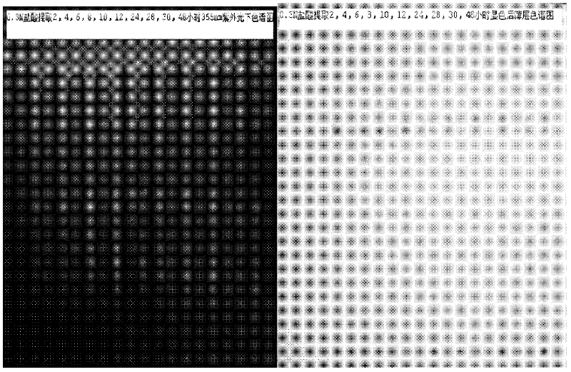 Method for preparing sinomenine hydrochloride injection