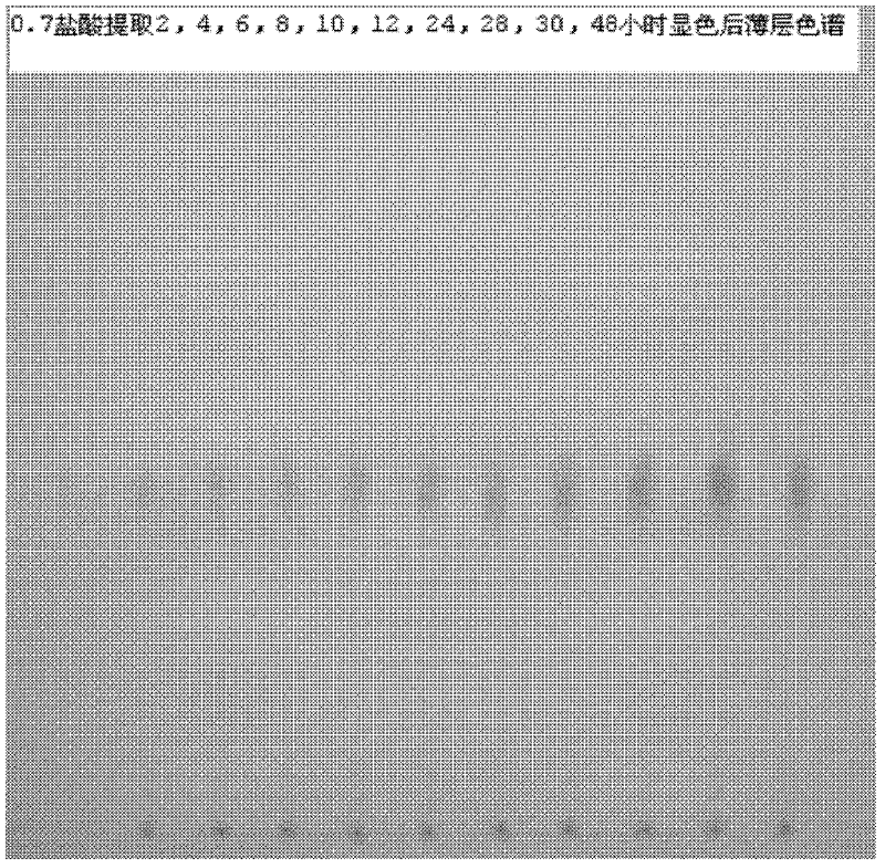 Method for preparing sinomenine hydrochloride injection