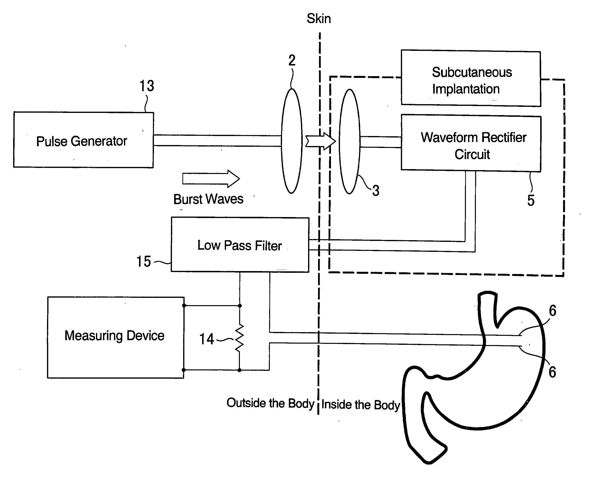 Device for electrically stimulating stomach