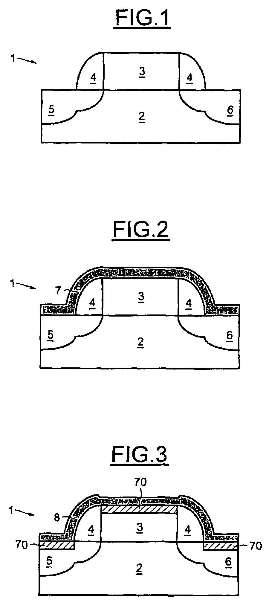 Method for the selective removal of an unsilicided metal