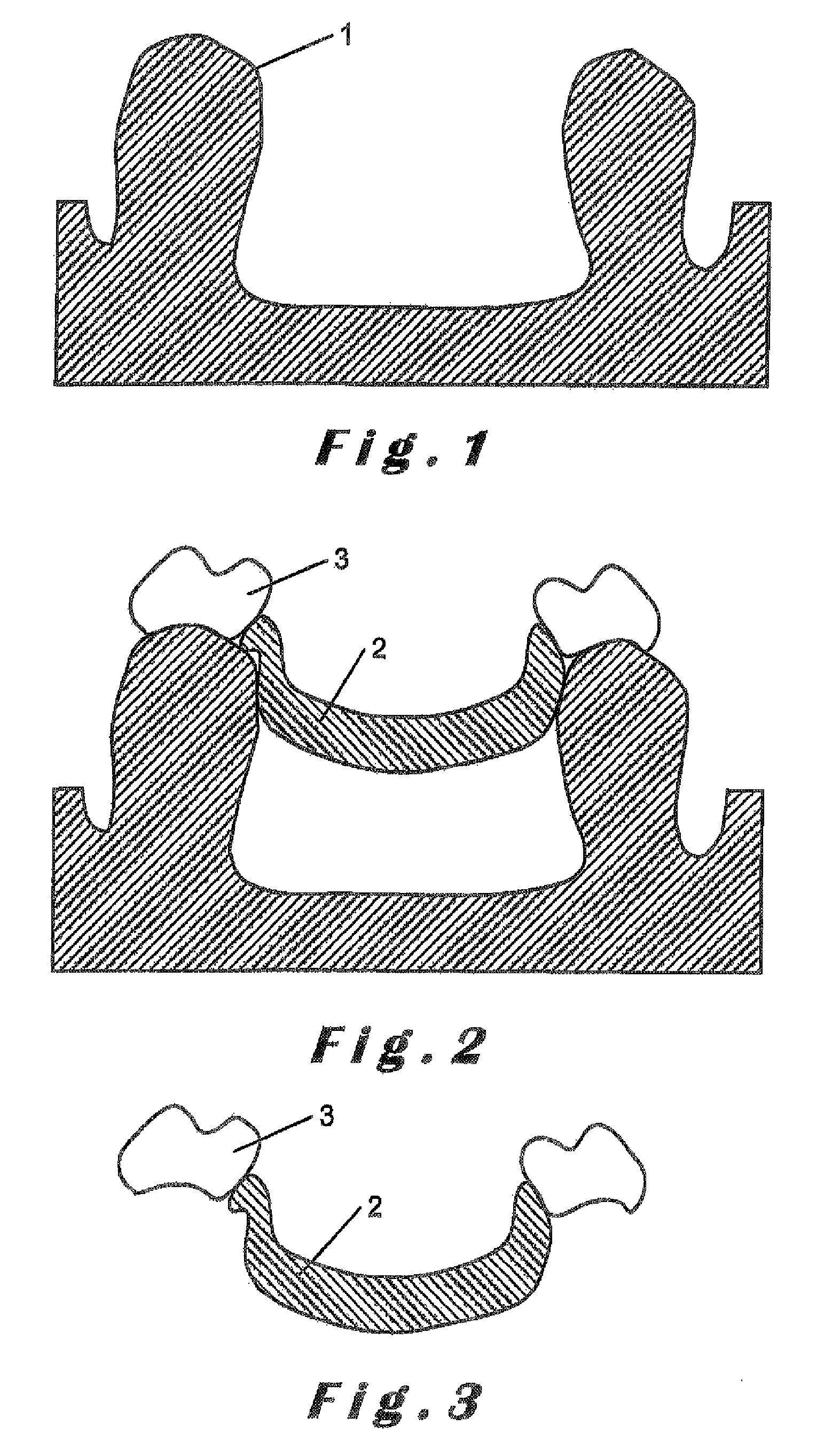 Method for manufacturing a dental prosthesis and an appliance for implantation thereof