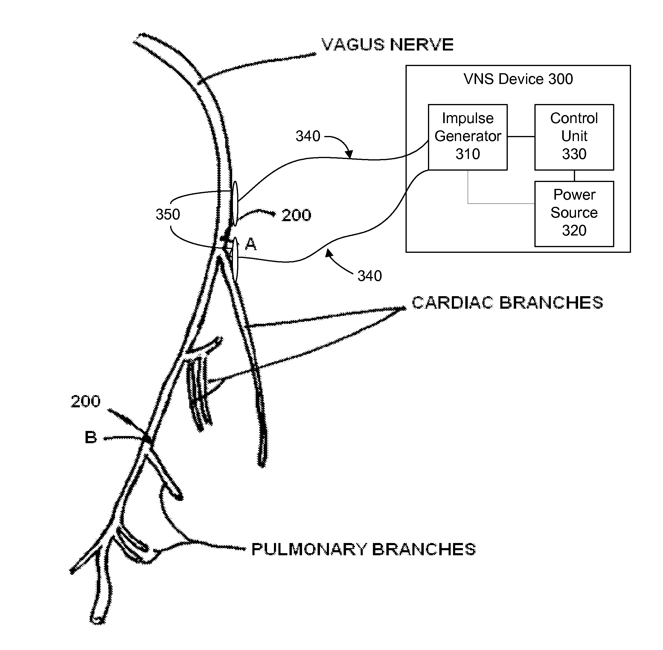 Electrical stimulation treatment of hypotension