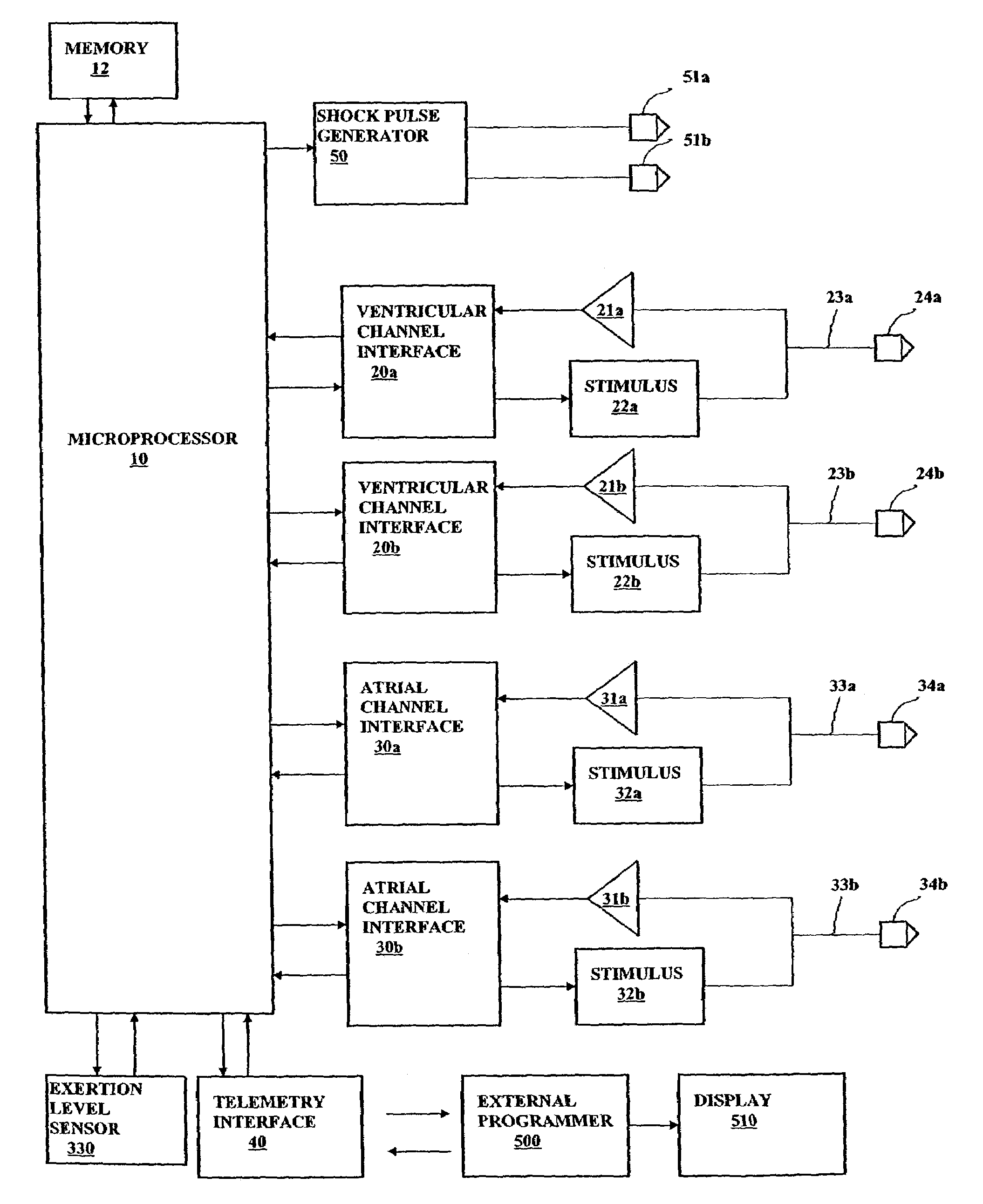 Apparatus and method for ventricular rate regularization