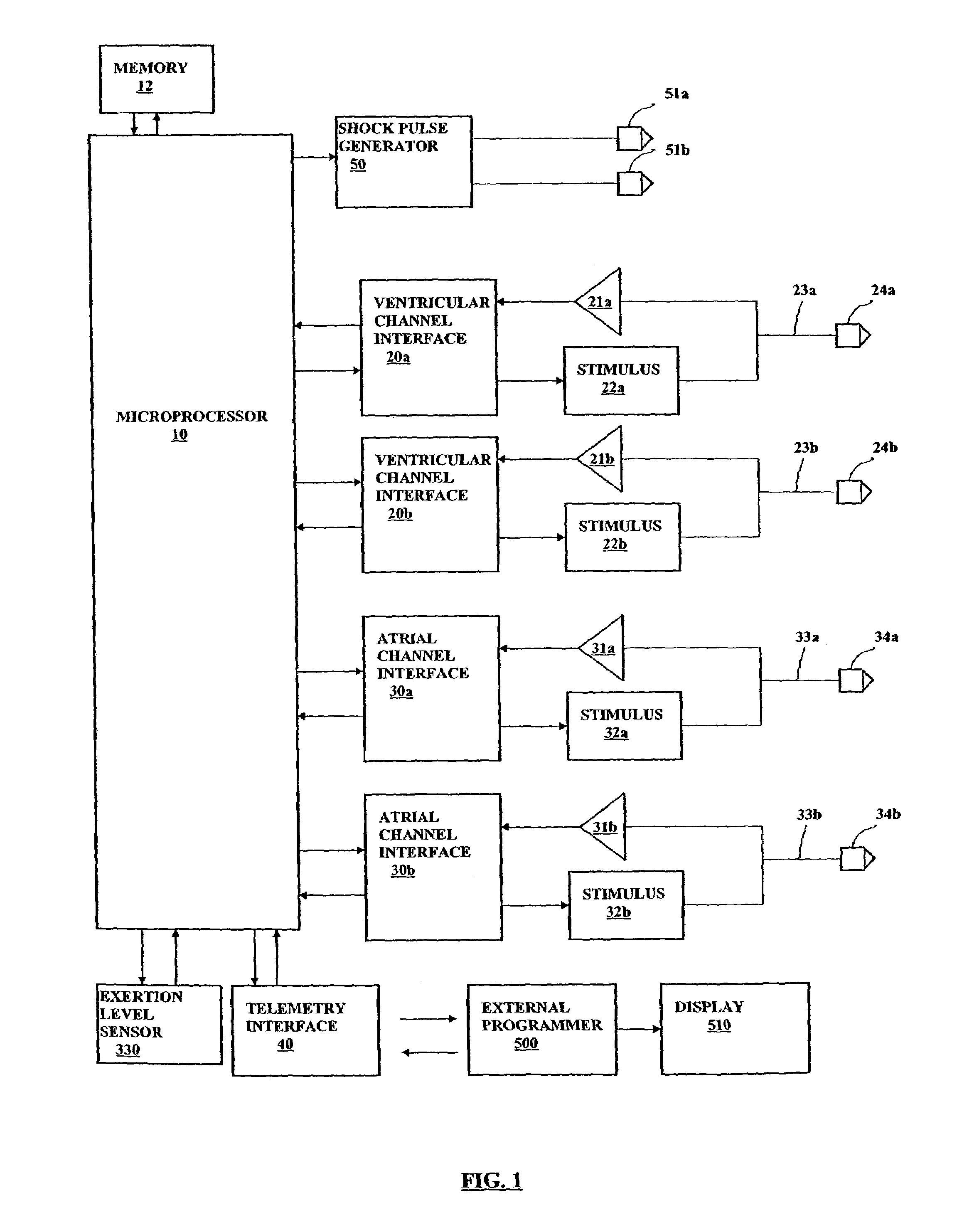 Apparatus and method for ventricular rate regularization