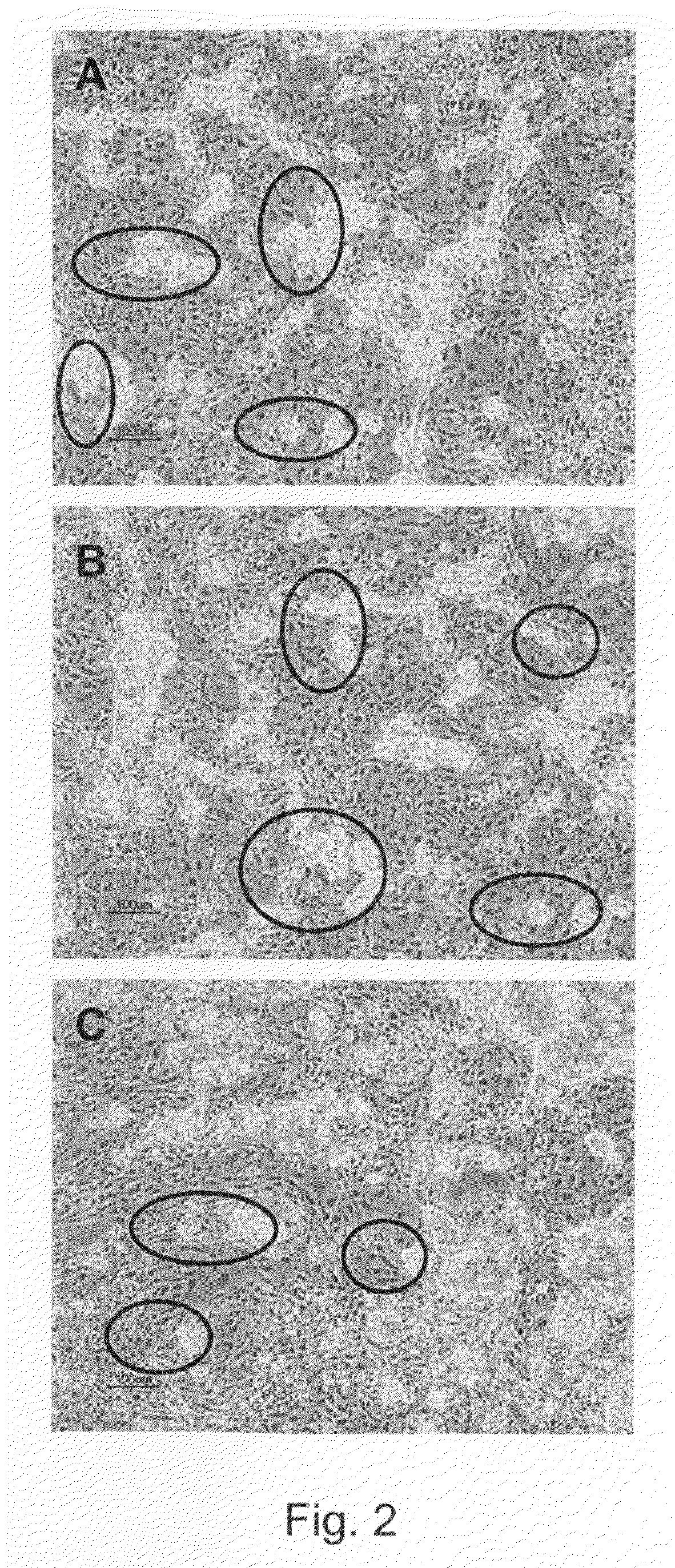 Population of multipotent cardiac precursor cells derived from human blastocysts derived stem cells